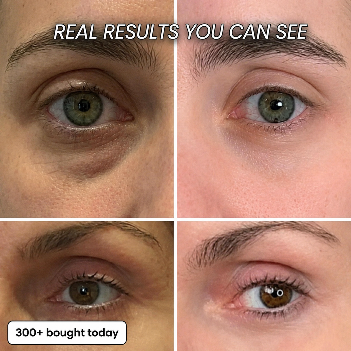Eye-area application and appearance results