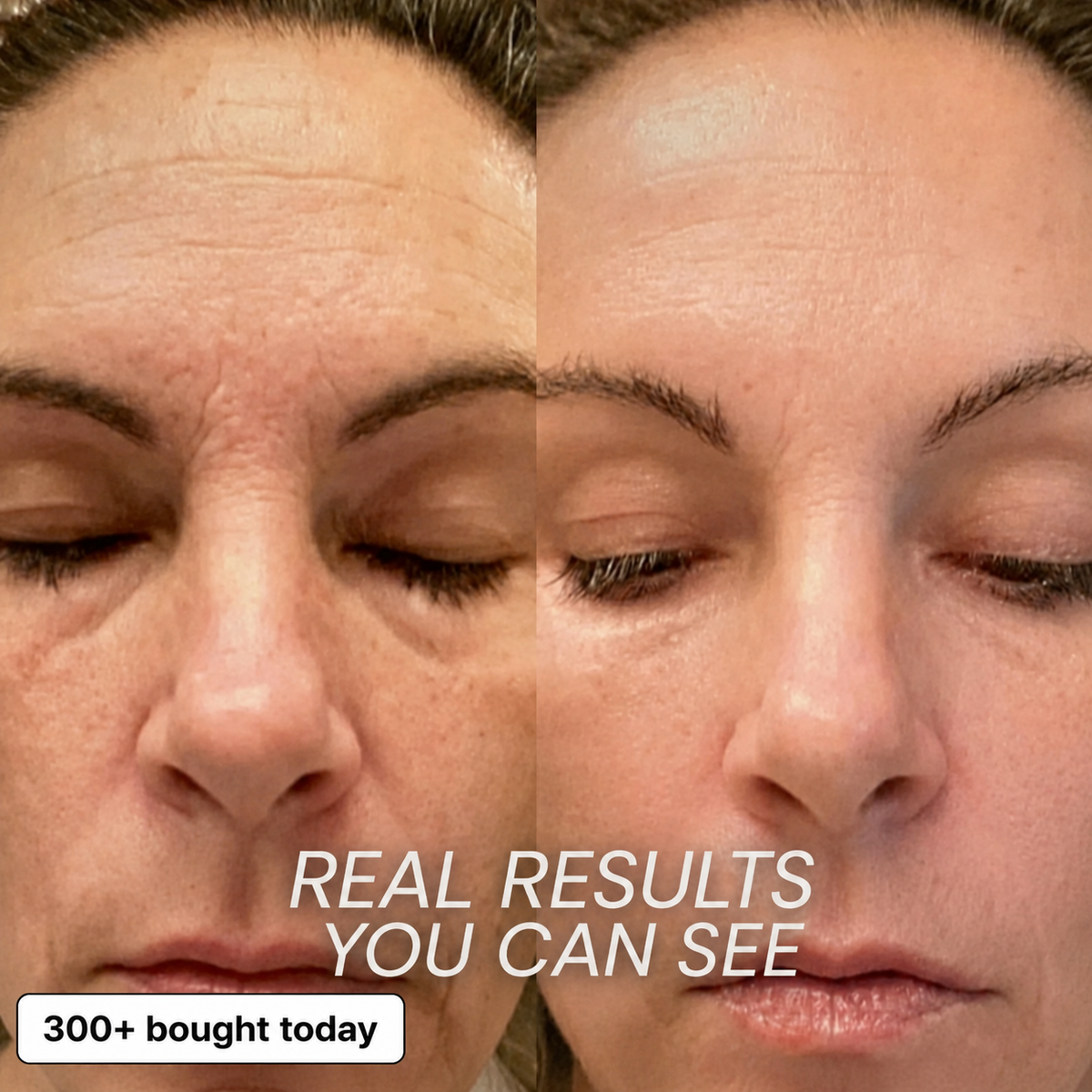 Forehead and facial application results
