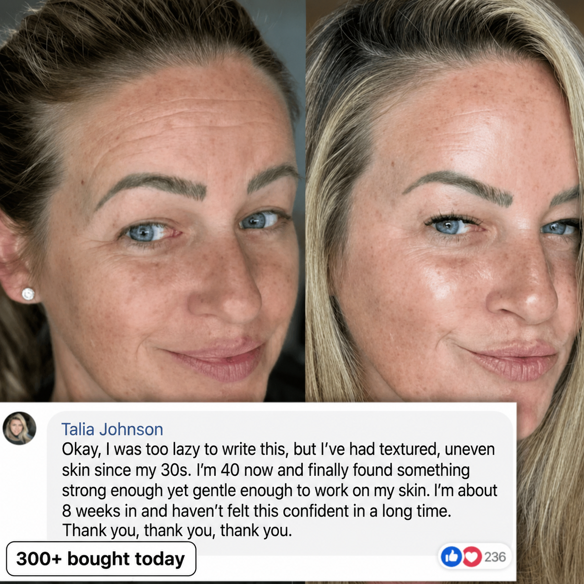 Skin texture appearance result