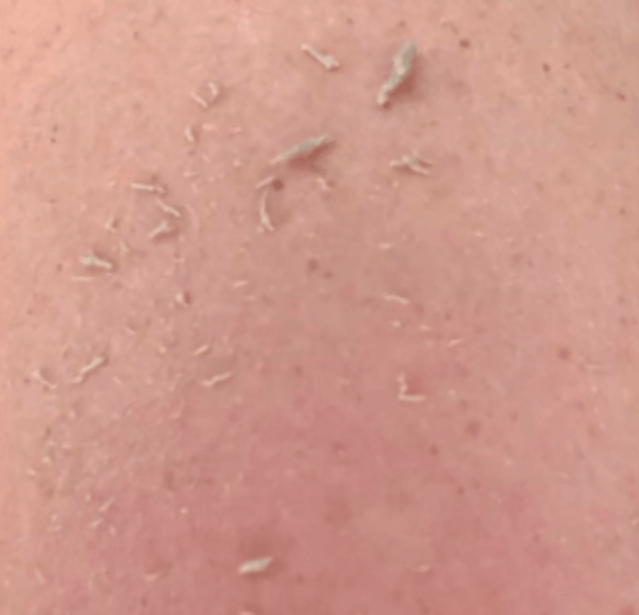 Demonstração de esfoliação no braço com luva Wildpier