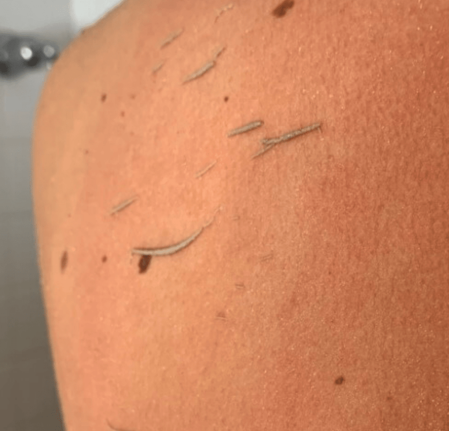 Demonstração de esfoliação corporal com luva Wildpier